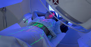Effetti Collaterali della Radioterapia, Costi e Rischi a Lungo Termine: Cosa Devono Sapere i Pazienti